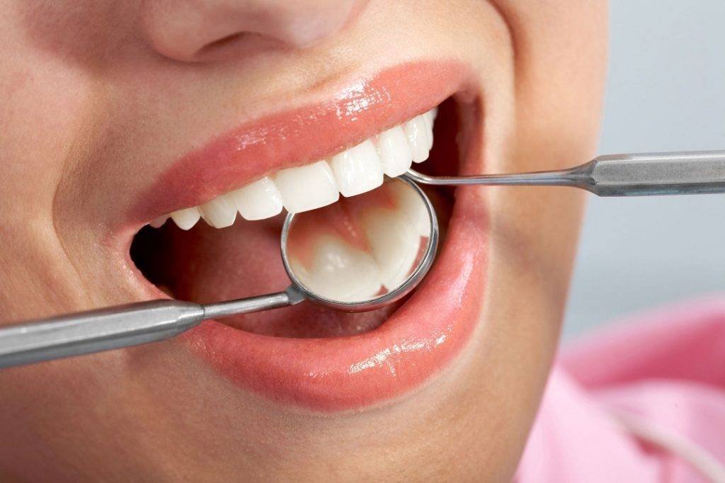 Cavity Treatment & Tooth Fillings